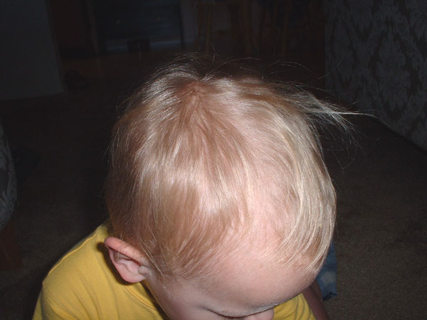 Atticus's poor bald head.jpg 59.4K